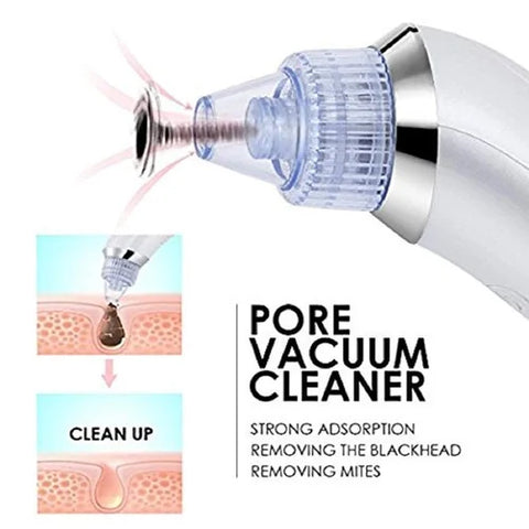4 in 1 Derma Vacuum Suction Blackhead/Acne/Pore Cleaner 🌞💁♀️
