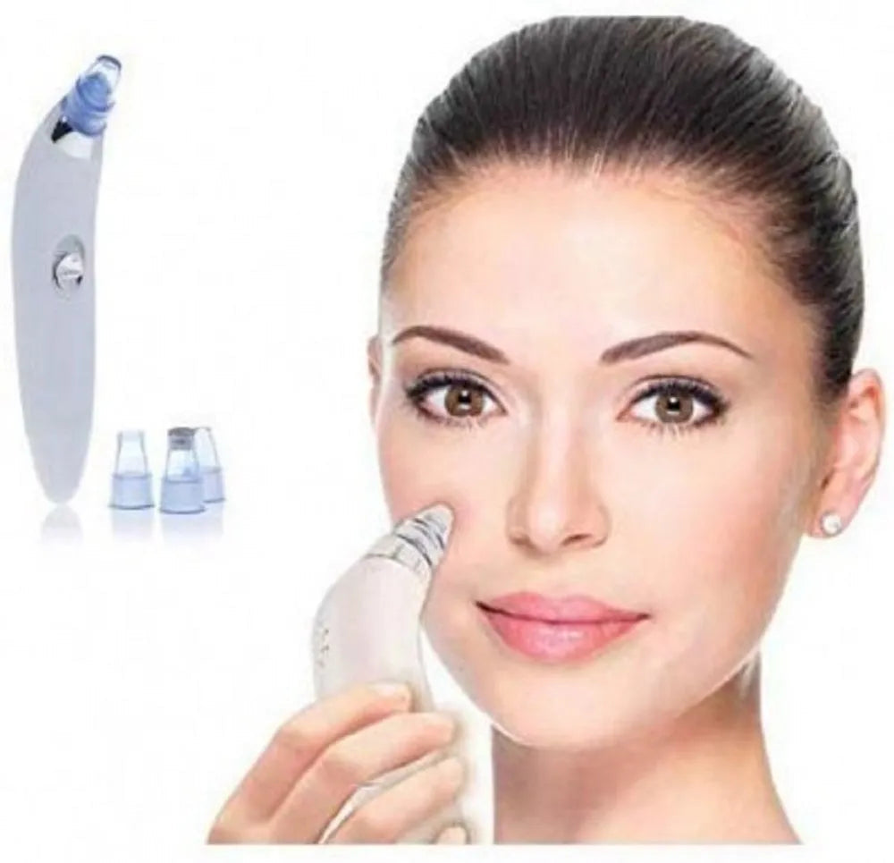 4 in 1 Derma Vacuum Suction Blackhead/Acne/Pore Cleaner 🌞💁‍♀️